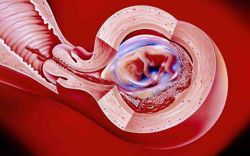 怀孕初期死胎有什么表现？