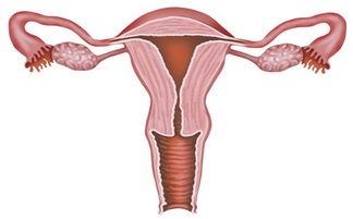 女性输卵管堵塞的症状有哪些？