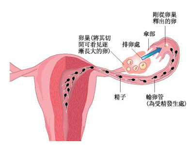  双侧输卵管粘连是什么？