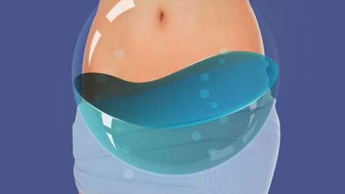 女性出现盆积液，对肚中胎儿有什么影响？