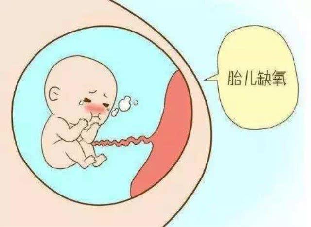 胎儿停产有什么症状？