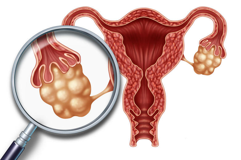 卵巢多囊什么时候需要去检查？应该挂哪个科室?