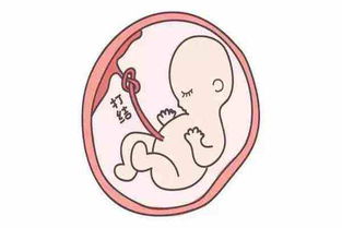 妊娠纹判断胎儿性别 原来还有这种操作