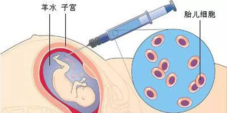 开放二胎政策的利与弊是什么？