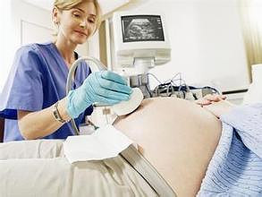 怎么怀孕几率高 怀孕初期症状