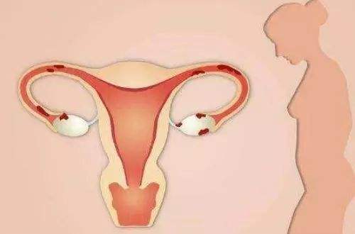 子宫内膜薄有什么危害？