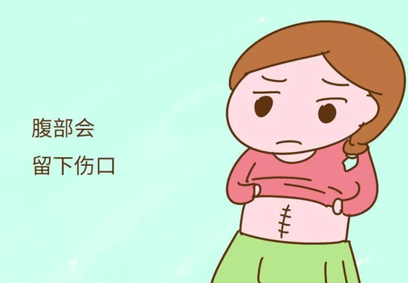有没有剖宫产术后1个多月上班的，对什么有何上海