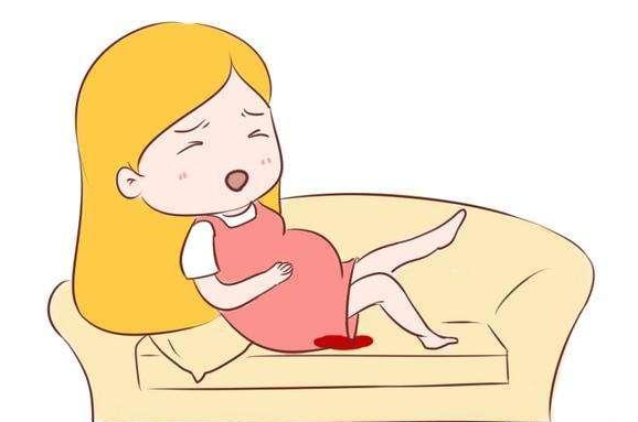 孕期出血但小腹不痛是什么原因？