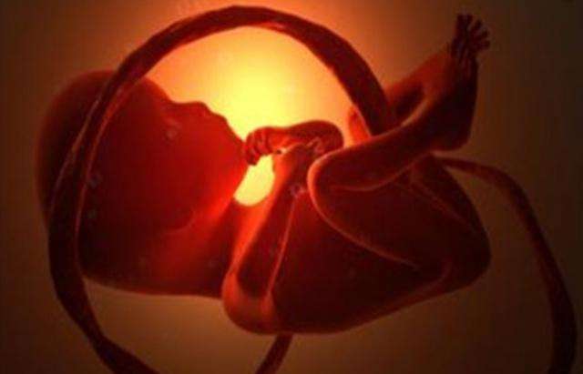 胎儿双侧肾盂无分离是什么意思？