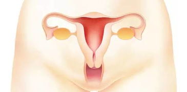 女人预防子宫内膜癌的五个小技巧