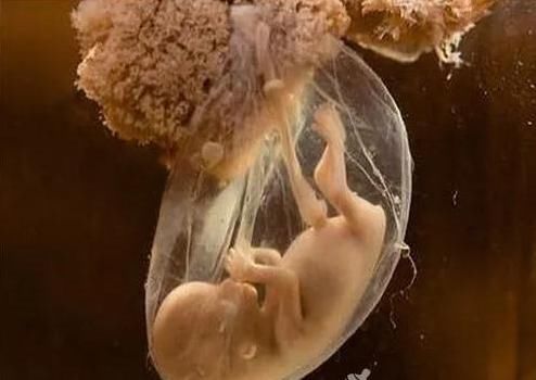 孕早期胎儿畸形的征兆是什么？