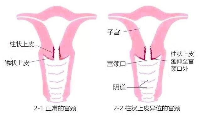 孕早期生男生女的症状有哪些不同？