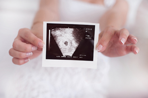 多囊卵巢怀孕了必须保胎吗？