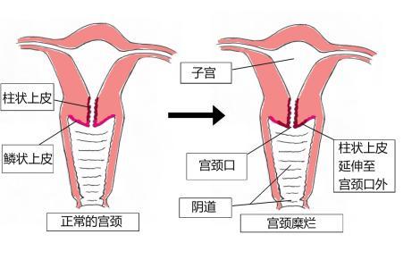 试管进周、促排、降调节是什么意思？