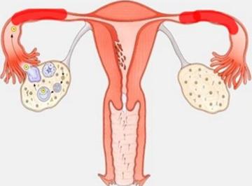 输卵管通而不畅怎么备孕容易成功？