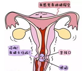 孕妇出现胎毒的症状有哪些？