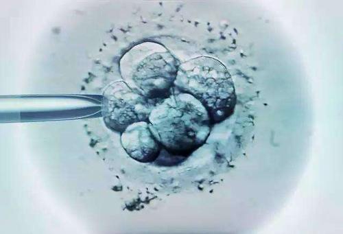胎儿性别预测 孕囊大小看男女准吗