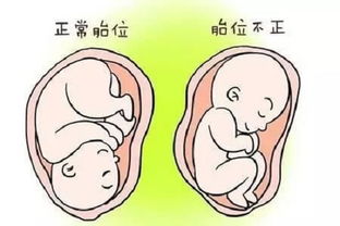 二胎孕前没补叶酸怎么办 孕后补来得及吗