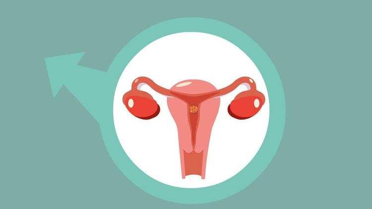 月经量少是卵巢早衰吗？