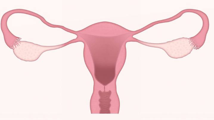 子宫肌瘤会遗传吗，附详细治疗方法