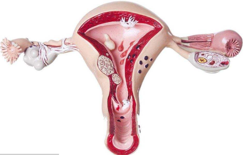 子宫内膜单纯性增生可以治愈吗？