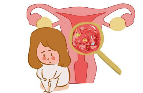 孕期妇科炎症反复发作怎么办
