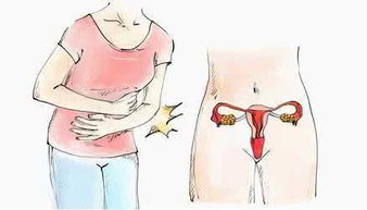 孕期正确保健从三个方法下手