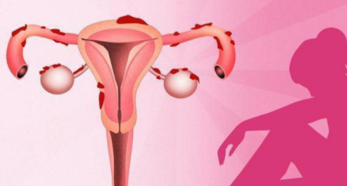 子宫内膜太薄怎么办？