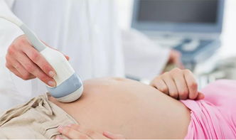 备孕期保健身体的两个好方法