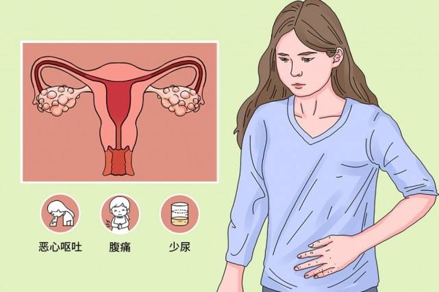 卵巢痛是什么征兆图片